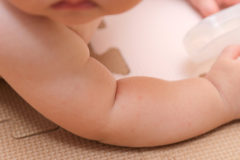 乳児湿疹の原因
