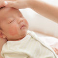 乳児湿疹の種類
