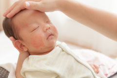 乳児湿疹の種類